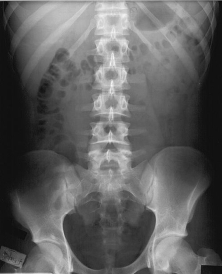 Radiographie standard